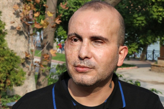 Görme Engelliler Teknolojik Araçlarda Kdv İndirimi ve Vergi Muafiyeti İstiyor.